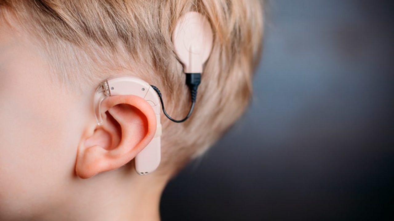 Cirurgia feita no HUM beneficia pacientes com perda auditiva severa